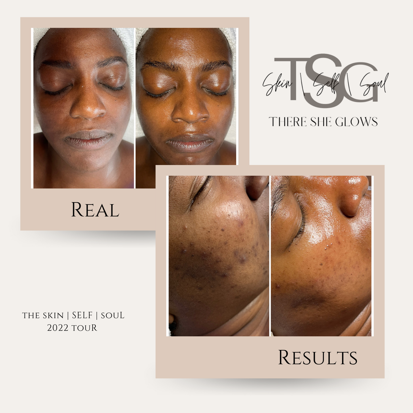 5 week Signature Glow Facial™️ Class— Take at Your Own Pace!