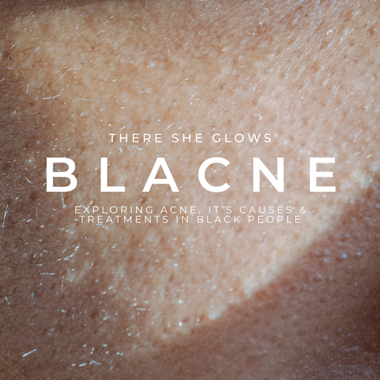 BLACNE Guide: What May Be Causing Your Breakouts
